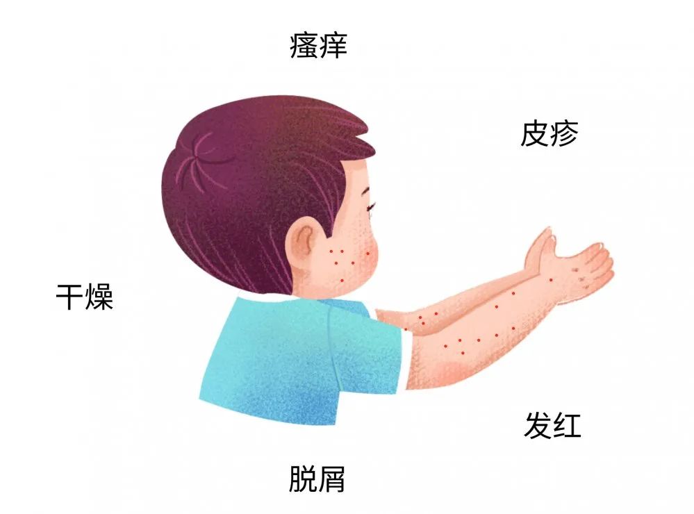 這些癥狀都可能是寶寶過敏傳遞的信號(hào)，很多寶媽還不知道